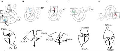 Case report: Atypical patterns of nystagmus suggest posterior canal cupulolithiasis and short-arm canalithiasis